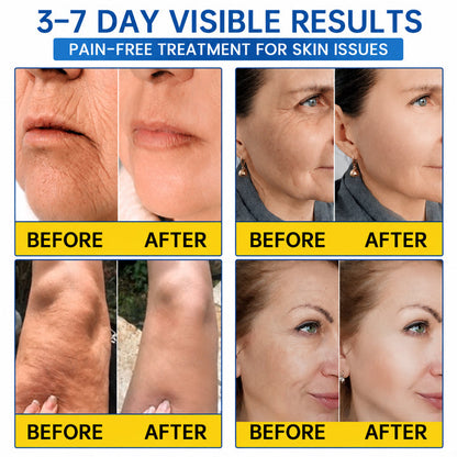 PDRN WRINKLE LIFT TIGHTENING CREAM 🌊