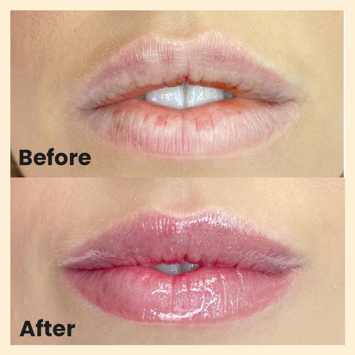 LIMETOW™ Propolis Peach Lip Serum