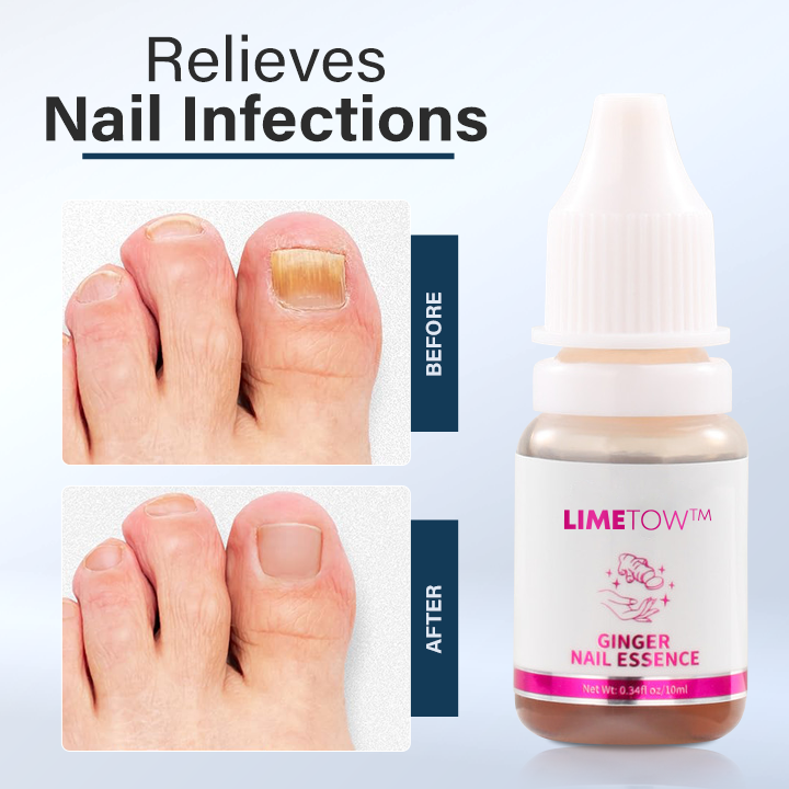 LIMETOW™ Ginger Nail Essence