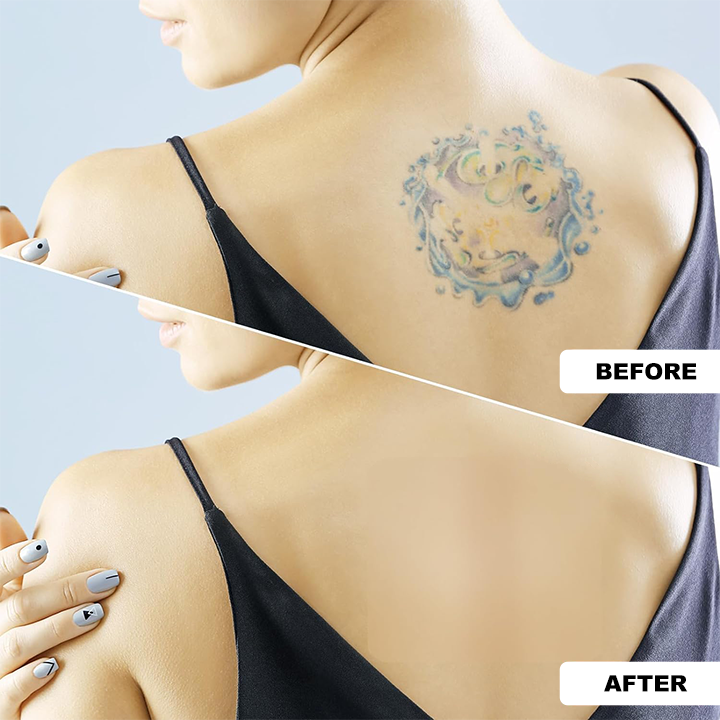 LIMETOW™ Ultra-Thin Tattoo Cover Up Sticker