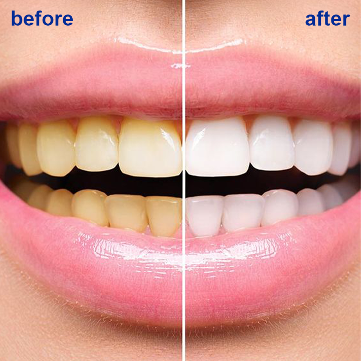 LIMETOW™ Teeth Whitening Powder